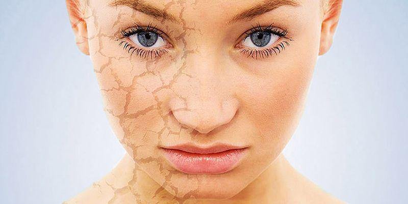 Dehydrated vs Dry skin. They're the same thing, right?